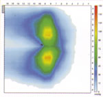 pressure area